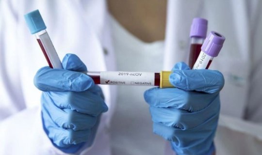 Payız gəldi, viruslar aktivləşdi: Mütəxəssislərdən vacib XƏBƏRDARLIQ