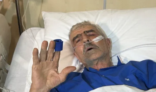 Təyyarə qəzasında yaralanan Zaqatala sakini&nbsp;vəfat etdi