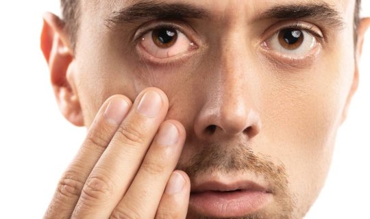 Göz sağlamlığını qorumağın 10 vacib qaydası - Oftalmoloqdan tövsiyələr