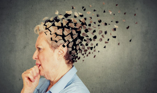Gündə 5000 addım alzheimer xəstəliyindən qorumağa kömək edə bilər
