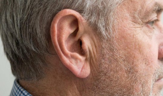 Qulaqdakı bu xətt infarkt riskini göstərir