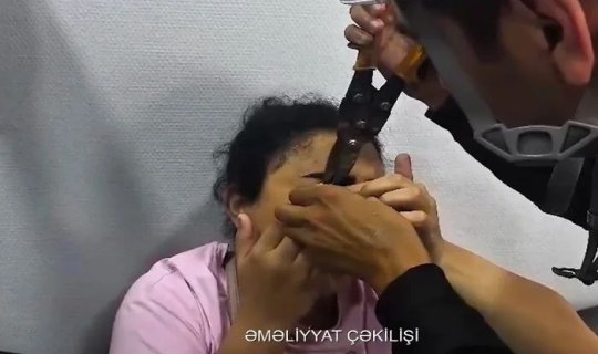 Göz qapağı zəncirbəndə ilişdi, FHN xilas etdi - Video