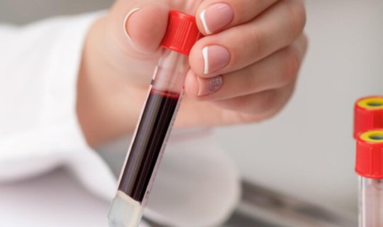 Diabet riski yüksək olan qan qrupu açıqlandı