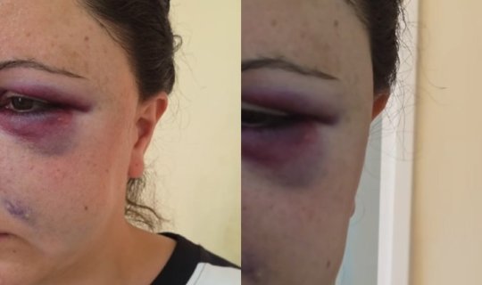 İllərlə zorakılıq görən qadın uşaqları ilə birlikdə sığınacağa yerləşdirildi -&nbsp;VİDEO