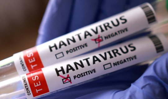 Hantavirusdan öldükləri təsdiqləndi