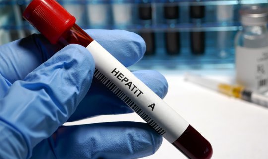 Azərbaycanda hepatitə yoluxanların sayı açıqlandı