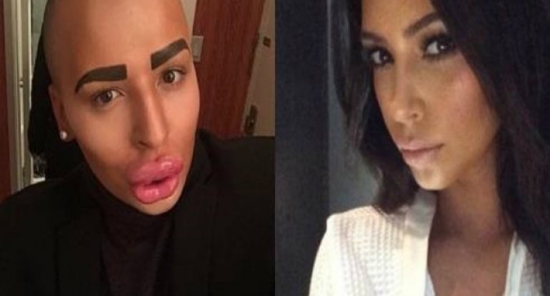 Kim Kardaşyana oxşamaq istəyən oglan özünü görün nə hala saldı