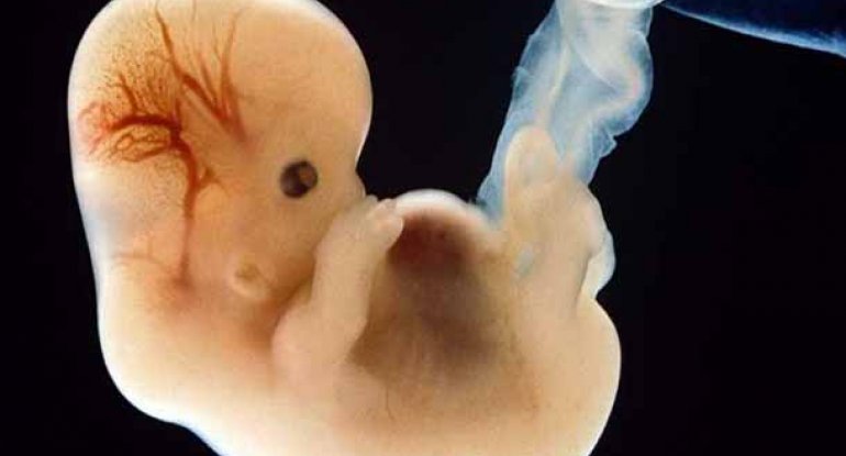 Niderlandda insan embrionları yetişdiriləcək