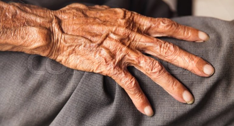 88 yaşlı kişi ehtiyatsızlıqdan yıxıldı