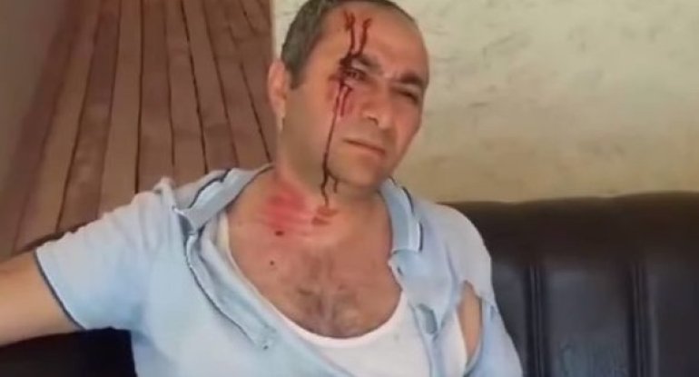 Evini yandıran veteran itkin düşüb