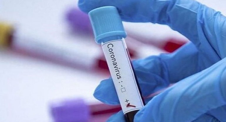 Azərbaycanda daha 64 nəfərdə koronavirus aşkarlandı