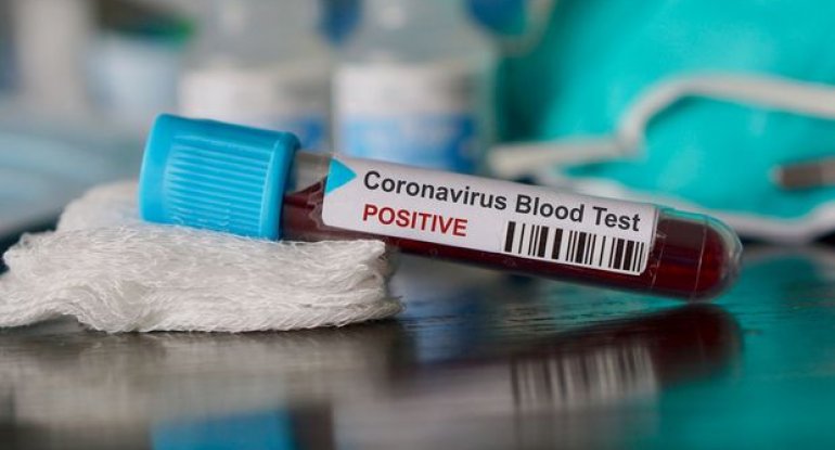 Azərbaycanda daha altı nəfər koronavirusdan sağaldı