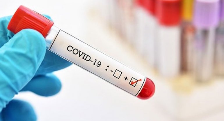 Çinin koronavirusla bağlı böyük yalanı ortaya çıxdı!