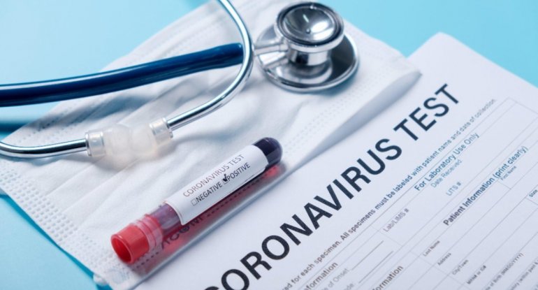 Milli Məclisin əməkdaşları koronavirus testindən keçirilir