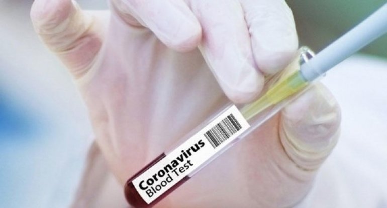 Azərbaycanda koronavirus testlərinin sayı