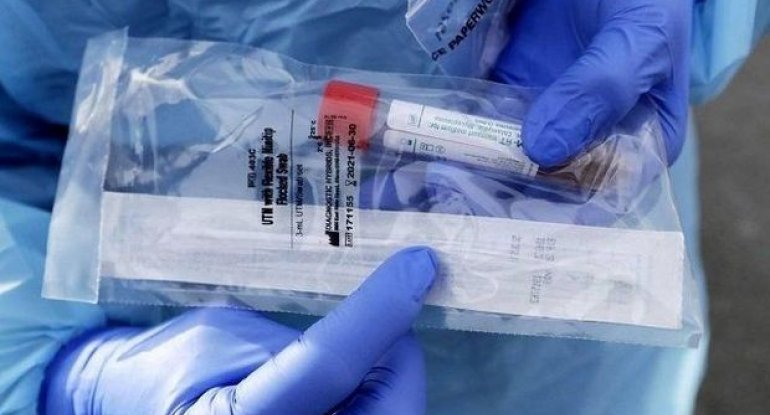 Bakıda xəstəxanada 33 tibb işçisi koronavirusa yoluxdu