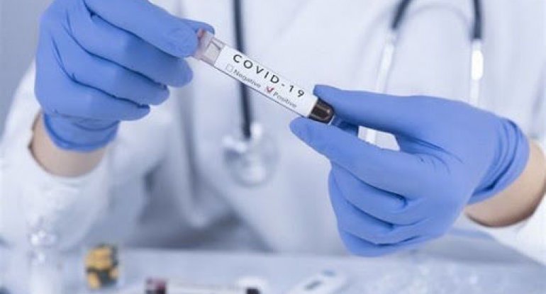 Bakıda koronavirus xəstələrini müalicə edən daha bir həkim COVID-19-a yoluxdu