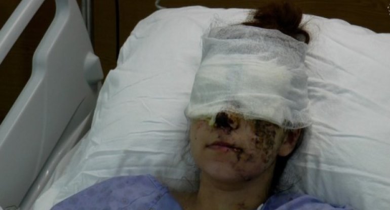 Ermənilərin Gəncə terroru iki uşaq anasını görmə qabiliyyətindən məhrum etdi - FOTO/VİDEO