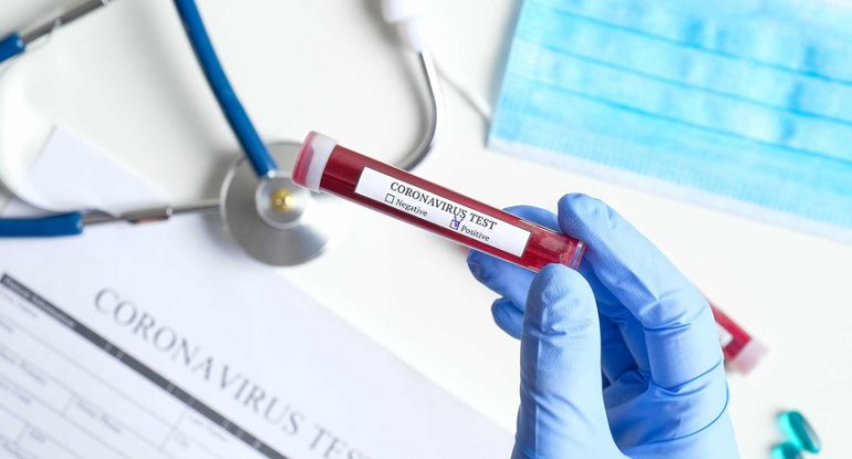 Bu şəxslərə koronavirus vaksini vurulmayacaq