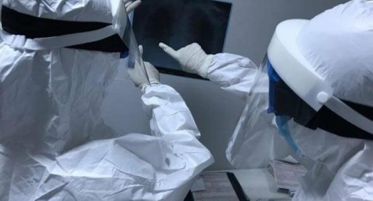 Koronavirus ömrü qısaldır? - Professor açıqladı