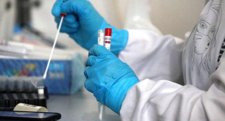 Azərbaycanda son sutkada koronavirusa yoluxanların sayı açıqlandı