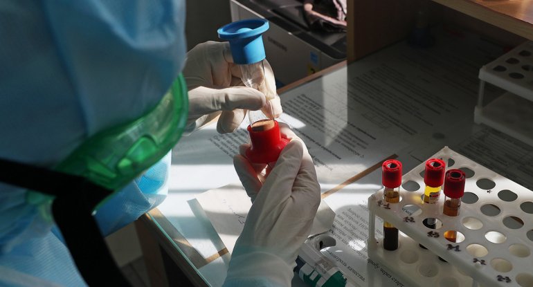 Koronavirus əleyhinə saqqız istehsal edilir
