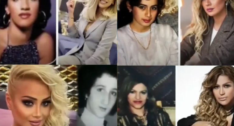 Yerli ulduzlar əvvəl və sonra - FOTOLAR