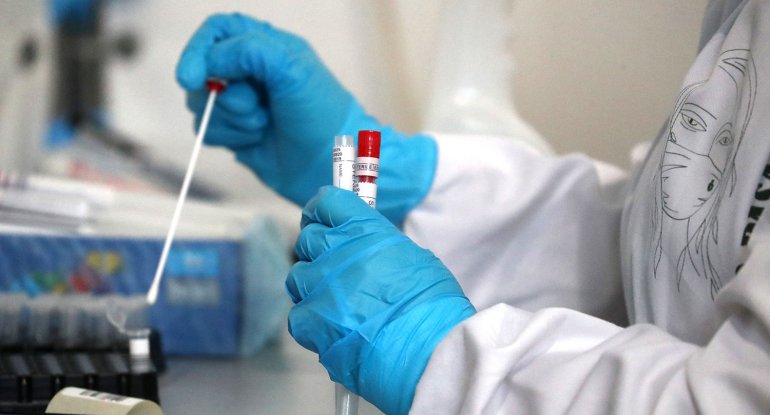 Azərbaycanda koronavirusdan ölüm qeydə alınmadı