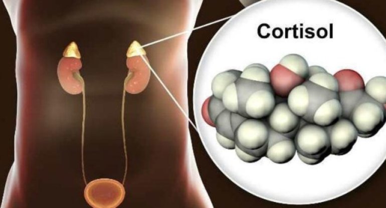 Stress hormonu: Kortizol - çox xəstəliklərin səbəbkarı - Necə idarə edək?