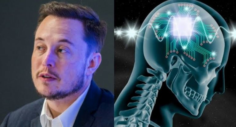 Elon Mask insan beyninə çip yerləşdirməyə başlayır - VİDEO