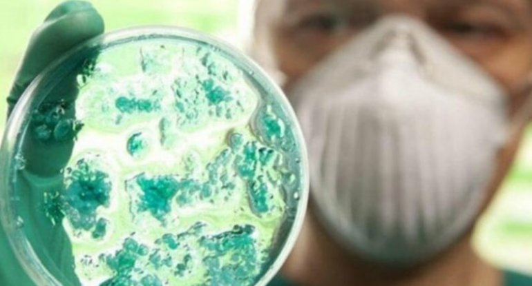 Bu əlamətiniz varsa, qrip deyil, koronavirus olmusunuz