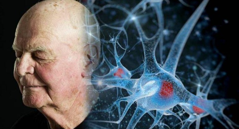 XƏBƏRDARLIQ: ağızdakı bu dad xərçəngin əlaməti ola bilər