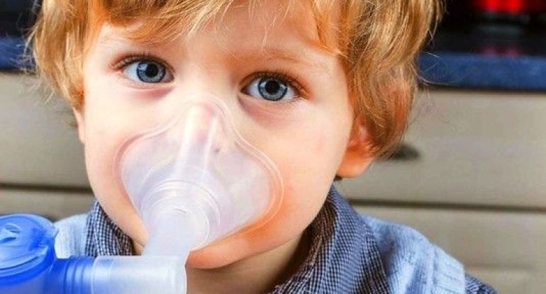 Uşaqları özbaşına inhalyasiya etməyin -xa0Səhiyyə rəsmisi