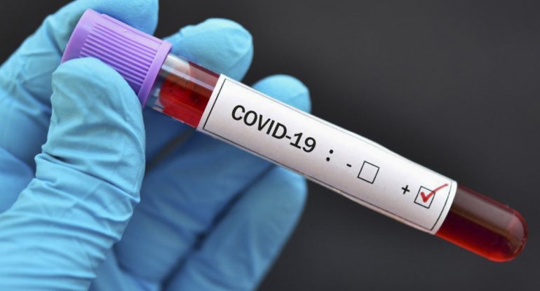 Azərbaycanda daha 757 nəfər koronavirusa yoluxub, 9 nəfər ölüb