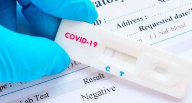 “PCR testi mənfi çıxanlar da koronaviruslu ola bilər” - İnfeksionist