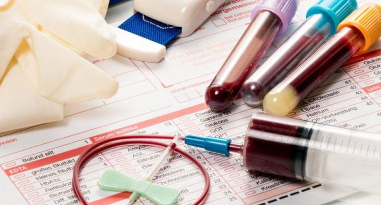 Ümumi qan analizində onkoloji xəstəliyi görmək olurmu? – Hematoloqdan açıqlama