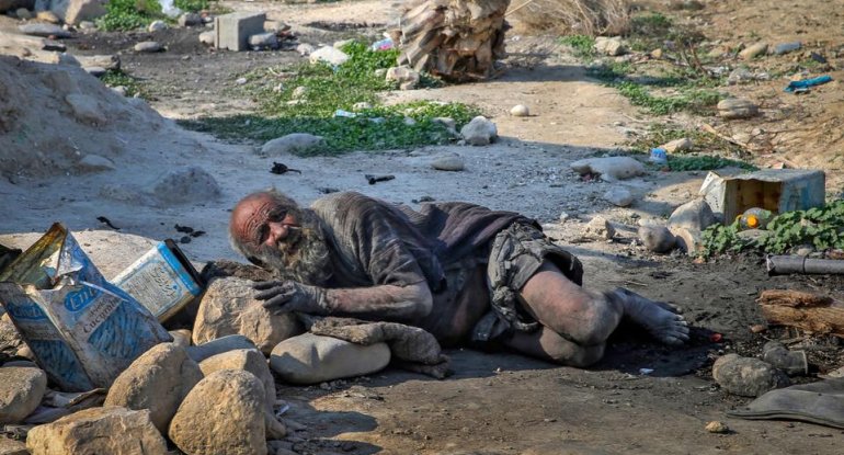 70 il sonra çimdi, faciə ilə sonlandı - FOTO