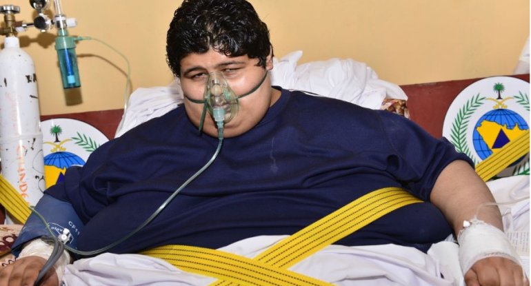 Dünyanın ən çəkili adamı 542 kq arıqladı: görənləri heyrətləndirdi - FOTO