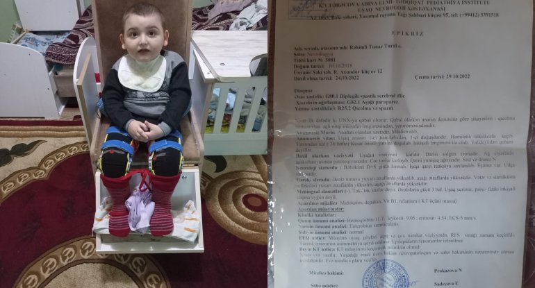 Dörd yaşlı Tunarın köməyinizə ehtiyacı var - FOTO/VİDEO