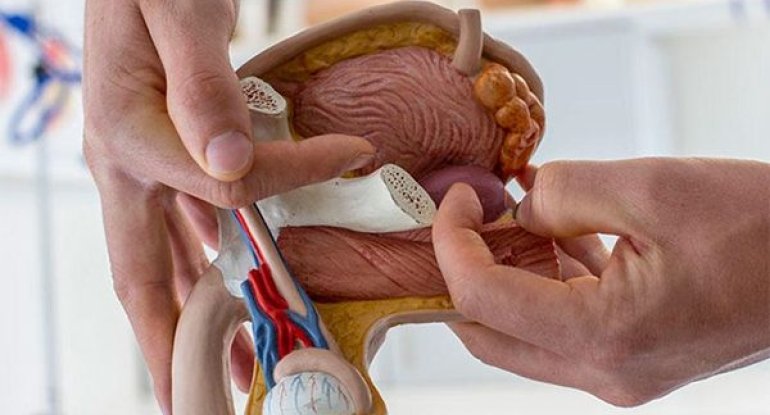 Prostat xərçəngini göstərən tualet simptomları