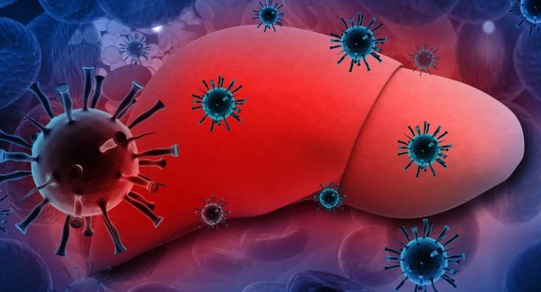 Bu il hepatit B və C diaqnozu qoyulanların sayı açıqlandı