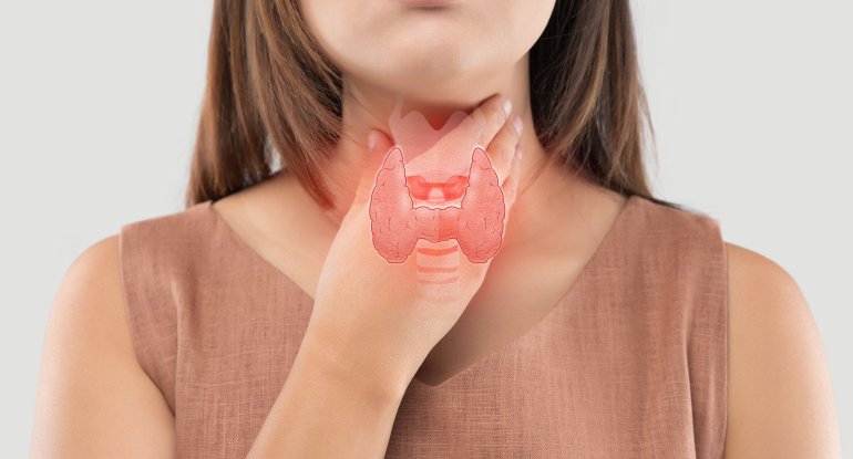 Üzün qızarması – Qalxanvari vəzin xərçəngi