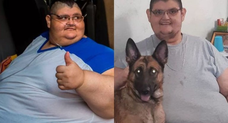 Dünyanın ən kök adamı 330 kiloqram arıqlayıb - FOTO