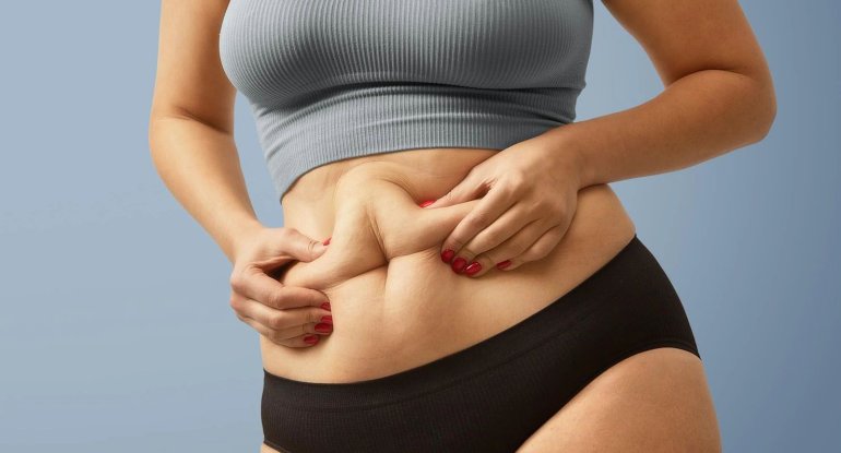 “Hormonal qarın” necə əmələ gəlir? – Azərbaycan kişilərinin problemi
