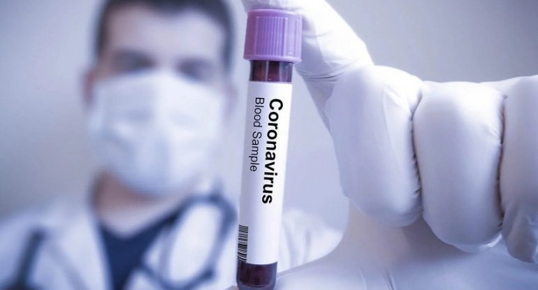 1 həftədə 95 nəfər koronavirusa yoluxub, 3-ü ölüb