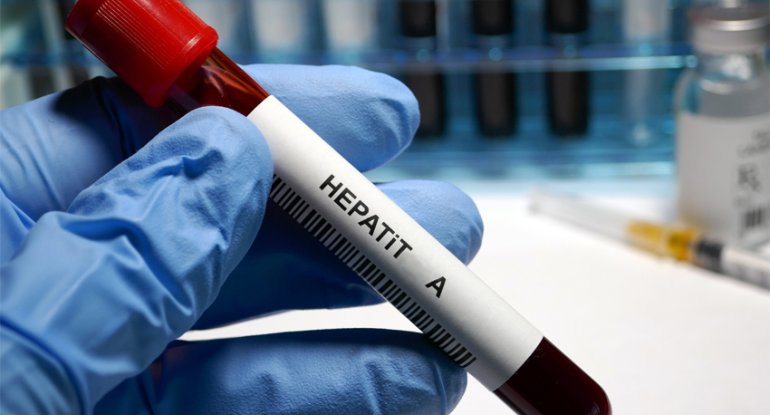 Səhiyyə Nazirliyindən Hepatit A AÇIQLAMASI