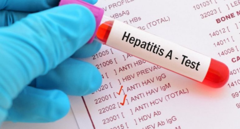 Hansı yaş qrupu uşaqlar Hepatit A virusuna daha çox yoluxur?