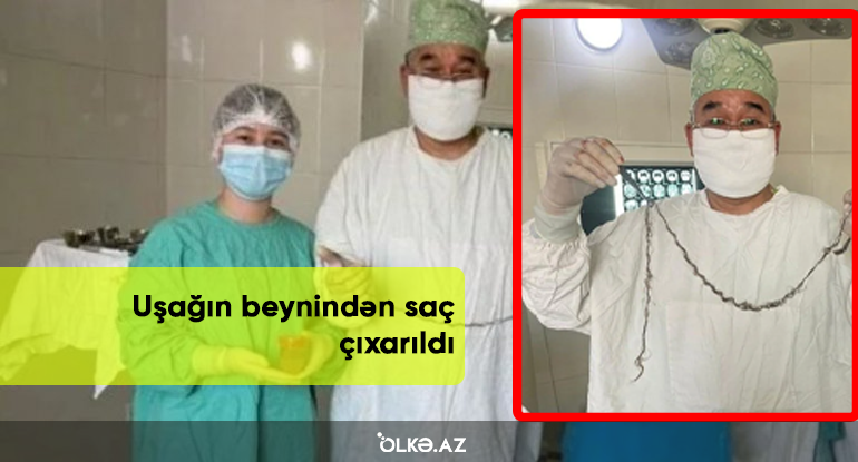 Uşağın beynindən saç çıxarıldı - FOTO