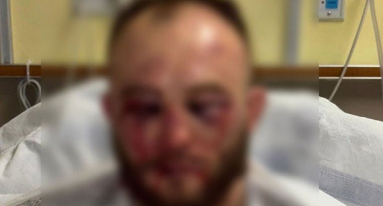 UFC ulduzunu tanınmaz hala gətirən nokaut: Xəstəxanadan son vəziyyətini paylaşdı - FOTO