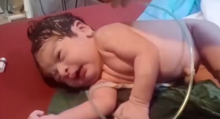 Ürəyi dayanan körpəni həkimlər həyata qaytardı - Video